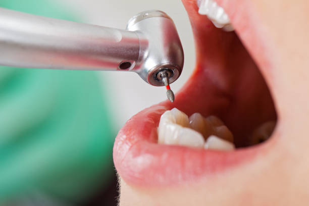 Best Emergency Gum Pain Relief  in Rock Port, MO